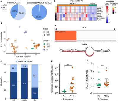 RNY4 in Circulating Exosomes of Patients With Pediatric Anaplastic Large Cell Lymphoma: An Active Player?